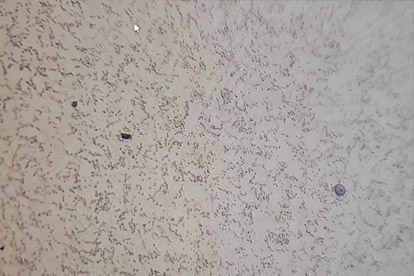 Badanie metalograficzne-500-krotne badanie metalograficzne